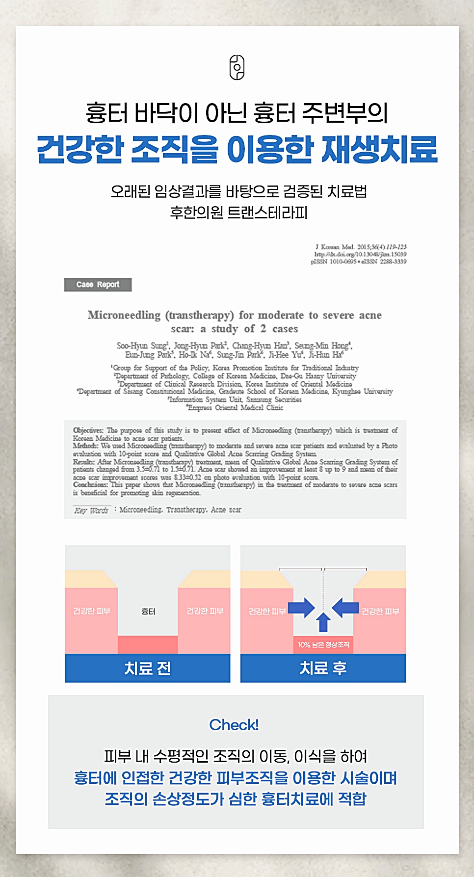 부천 여드름흉터 치료법 트랜스테라피 원리와 임상 연구 자료