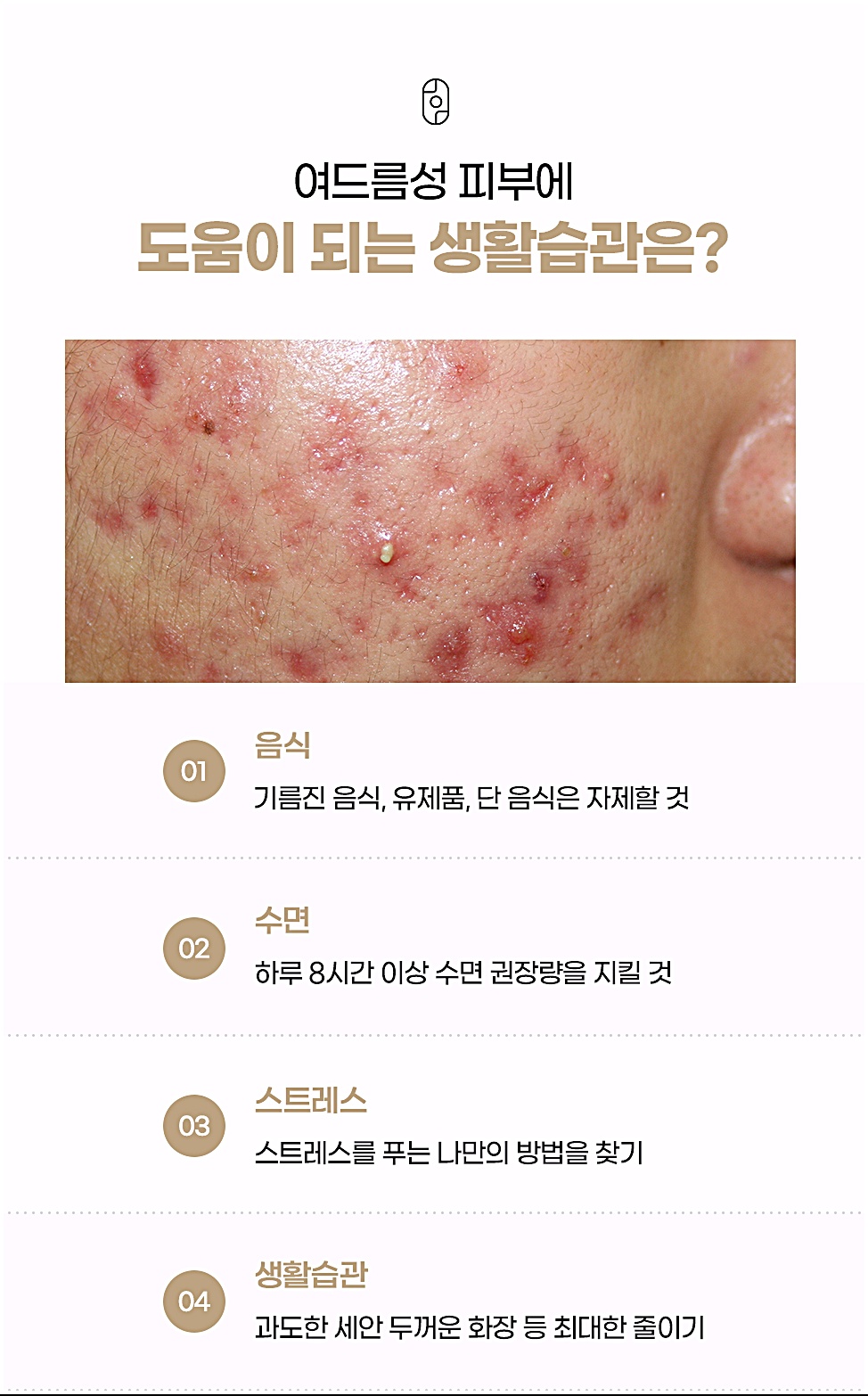 부천여드름 피부과 여드름성 피부에 도움되는 생활습관