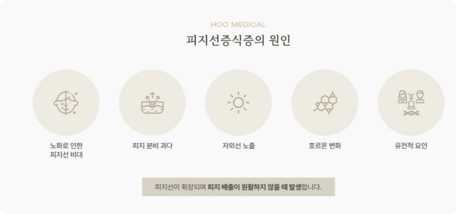 부천피지선증식증의 원인 5가지 - 노화, 피지분비, 자외선, 호르몬, 유전