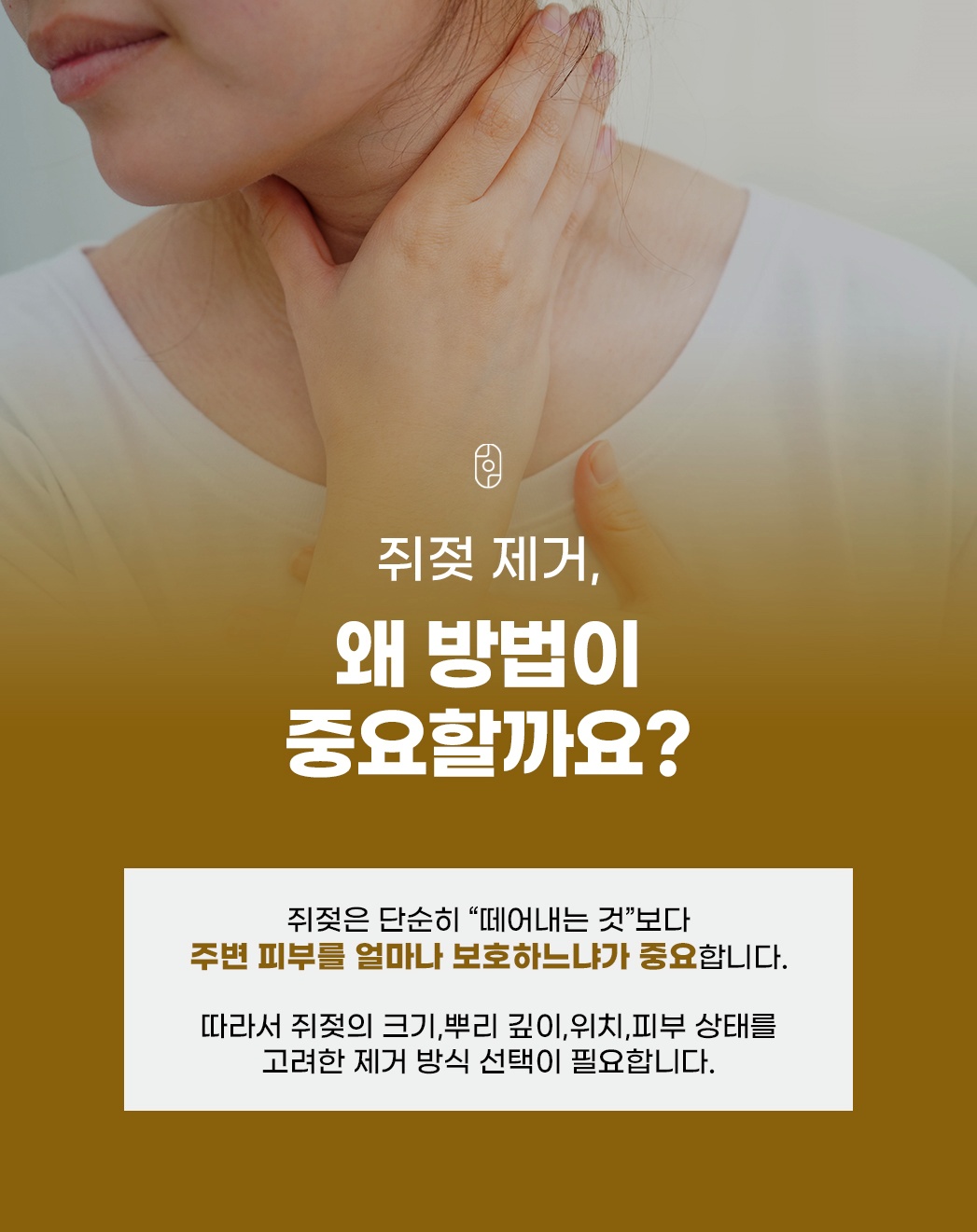 부천쥐젖 제거 시 주변 피부 보호 및 맞춤 시술의 중요성