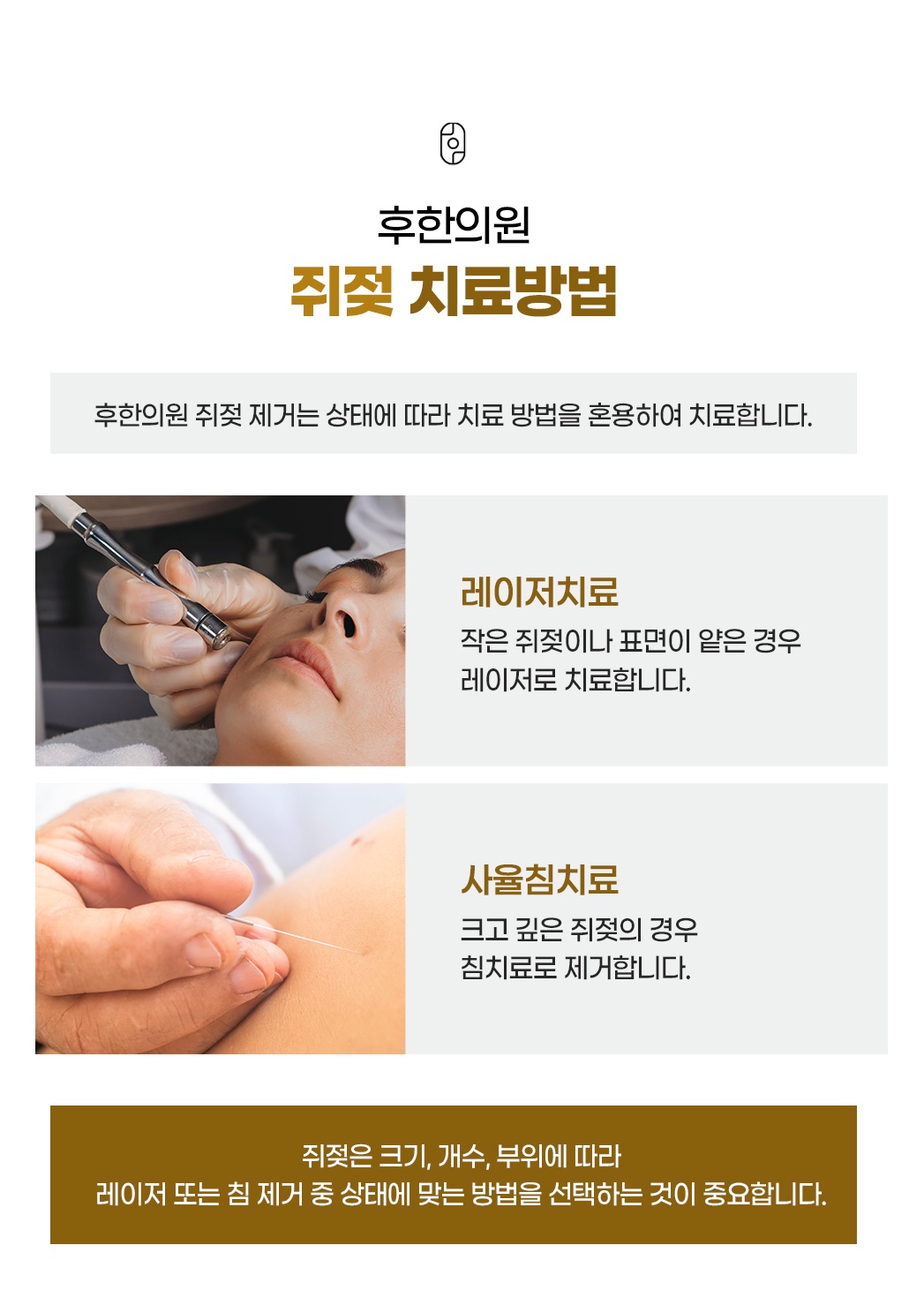 후한의원 쥐젖 치료 방법 레이저치료 및 사율침치료 안내