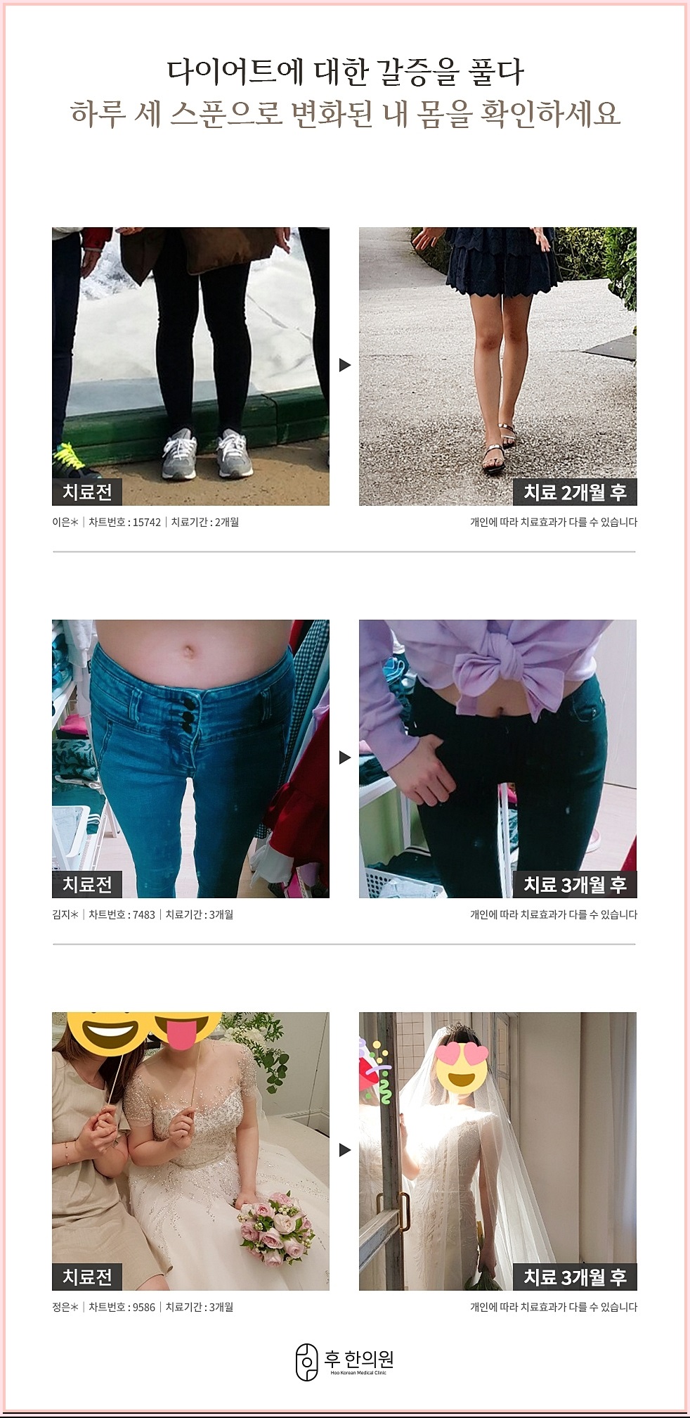 다양한 다이어트 감량 케이스 사진