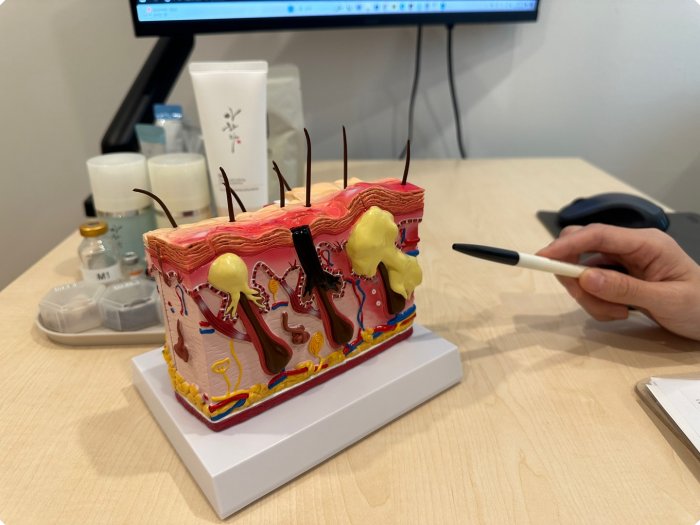 후한의원 부천점 상담실의 피부 단면도 모형 - 각질층, 진피, 피하지방, 피지선, 모낭충의 위치를 보여주는 교육용 모형