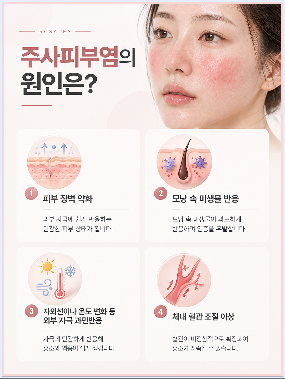 주사피부염의 원인을 정리하는 이미지