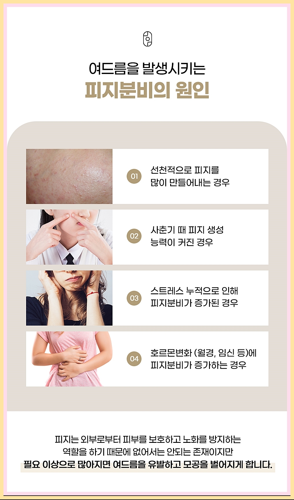 여드름의 발생 원인 피지 중심의 이미지