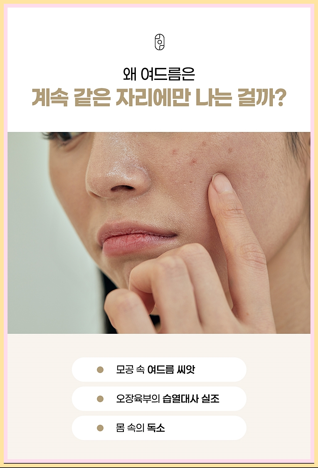 같은 자리에 여드름이 반복되는 이유 이미지