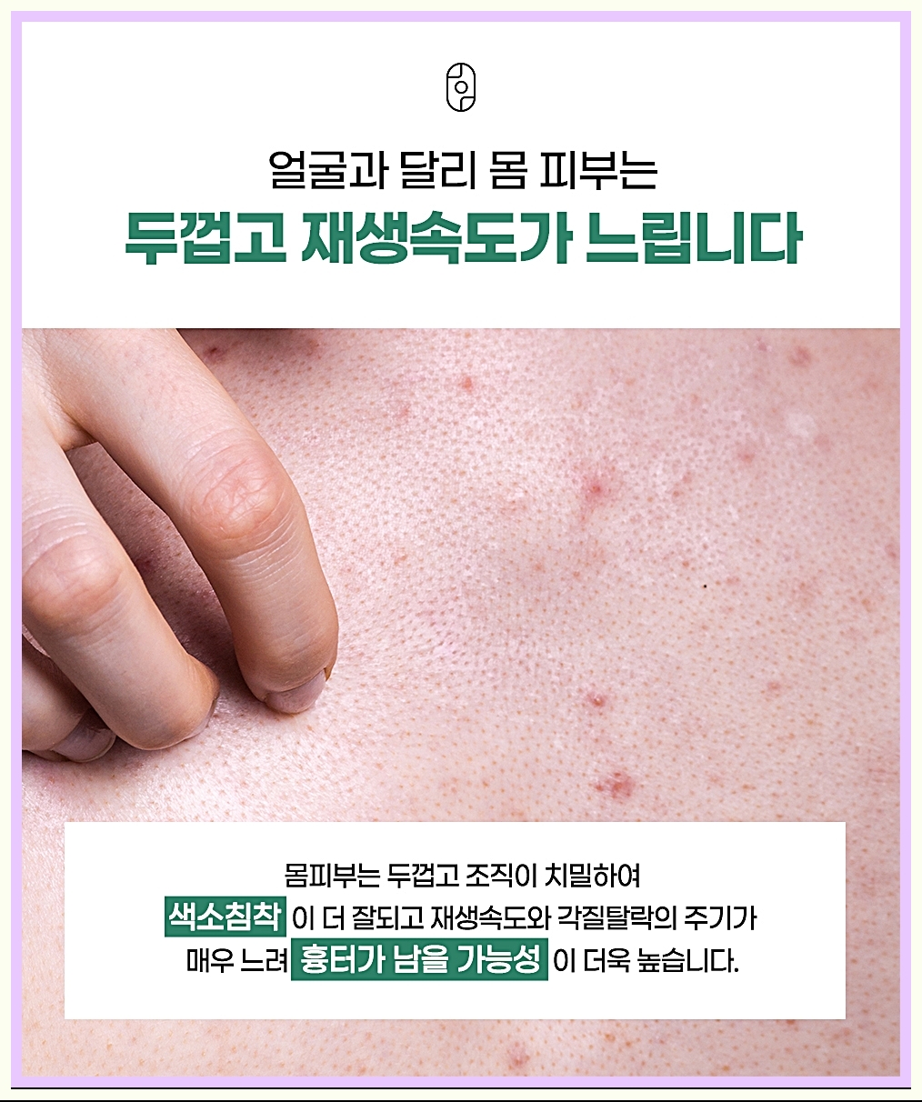 등피부의 특징 및 등여드름이 퍼지는 이유 이미지