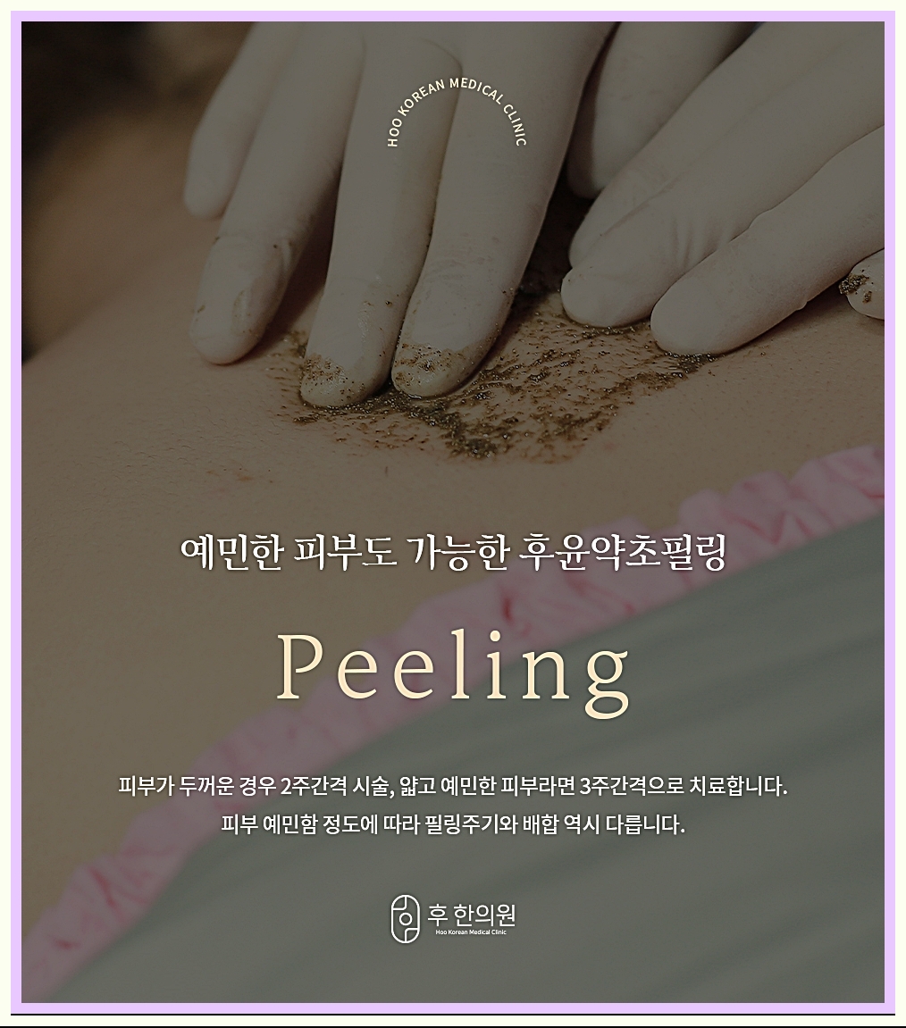 부천등여드름 후윤약초필링 설명 이미지