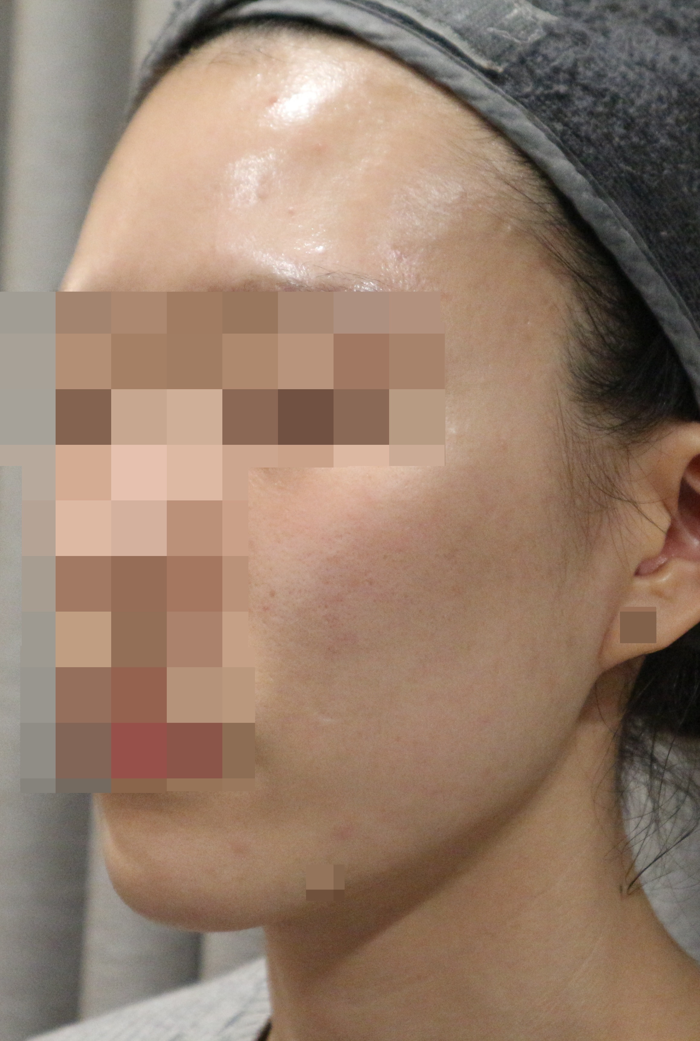 After
