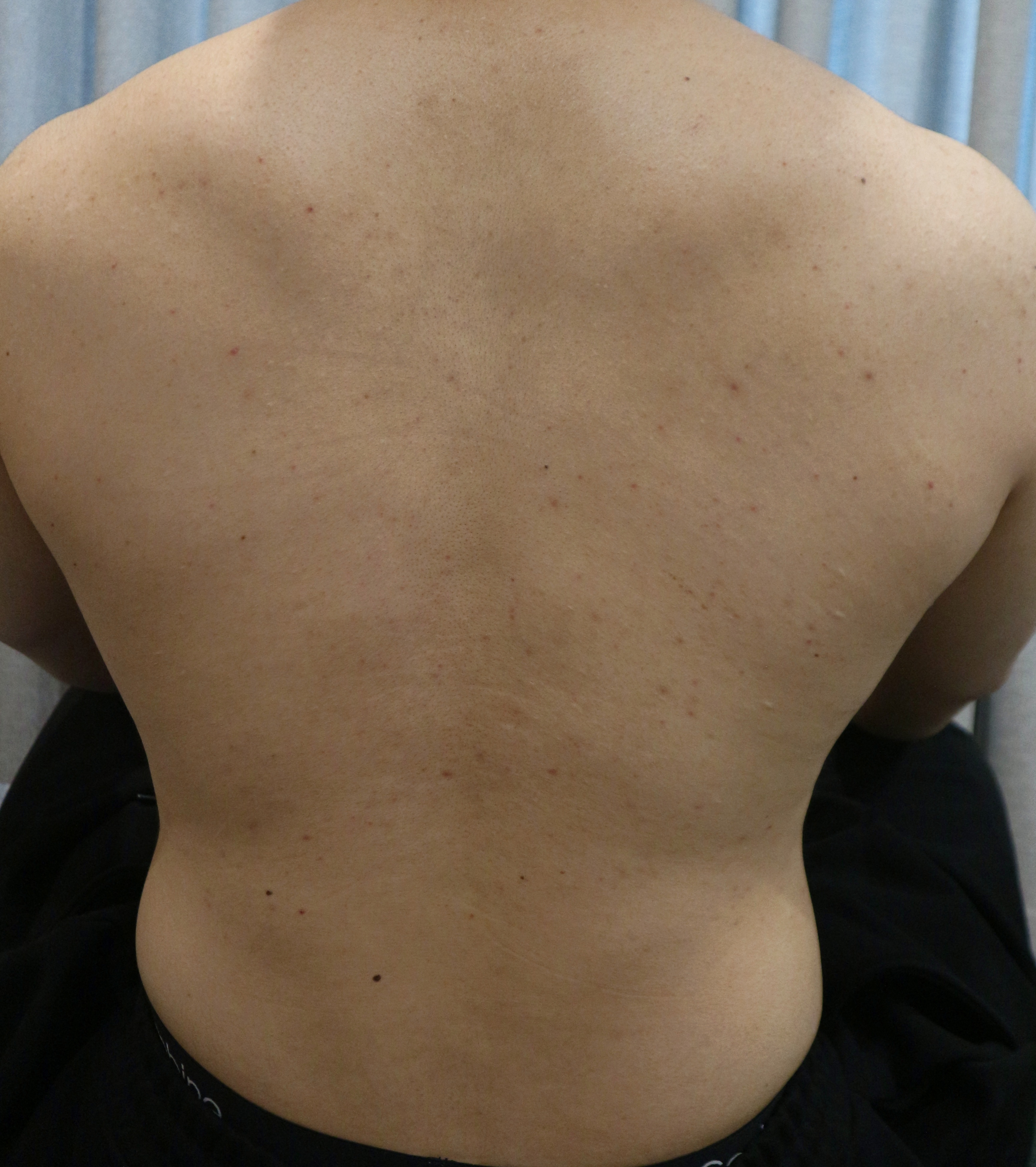 Before