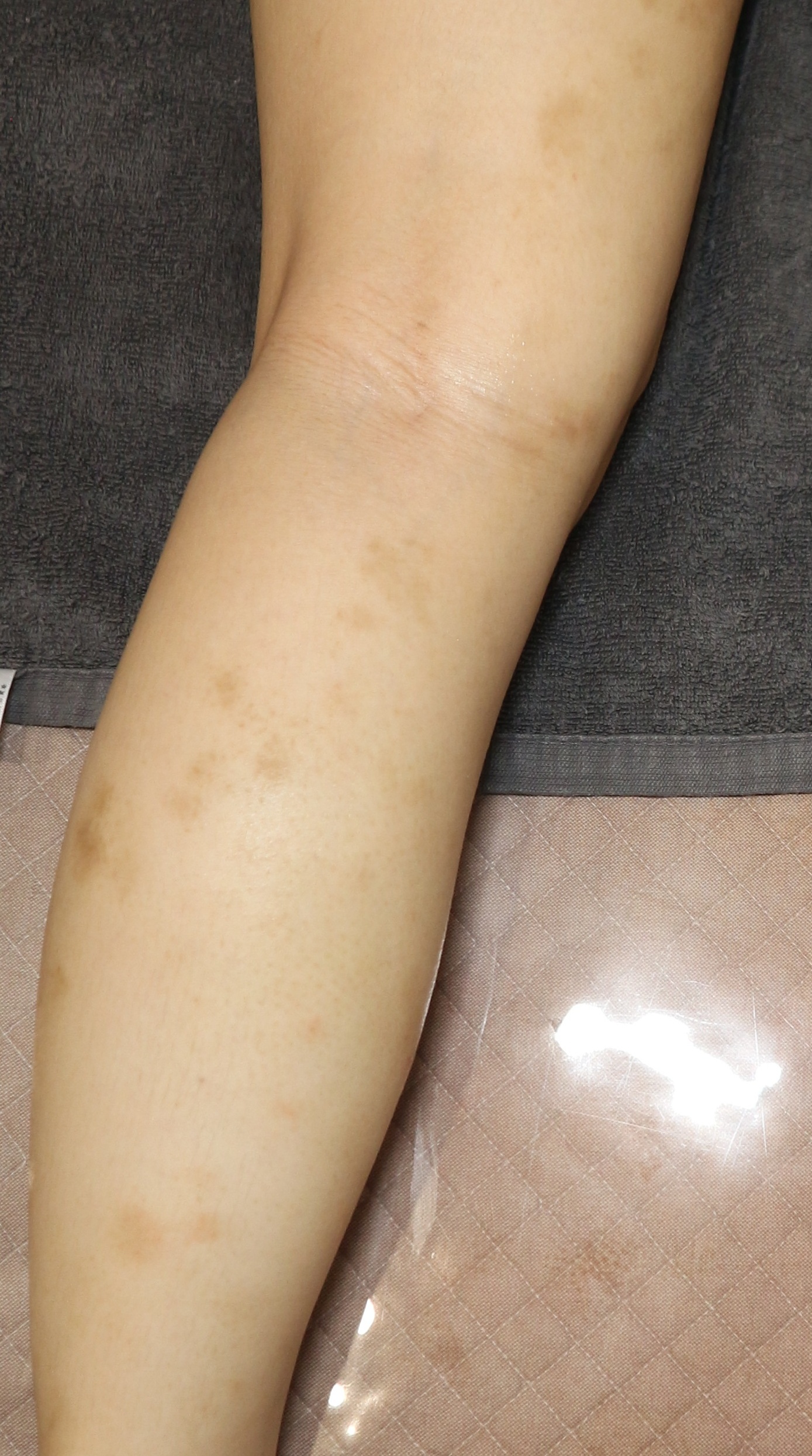 Before