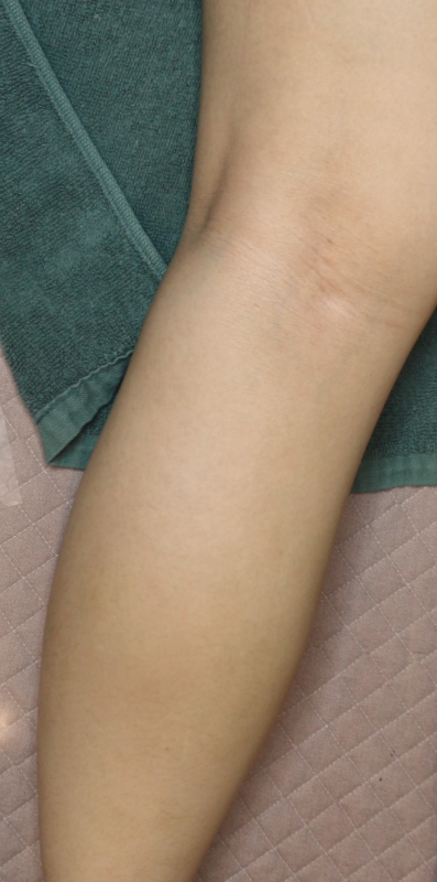 After